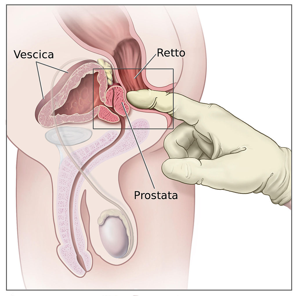 esame della prostata